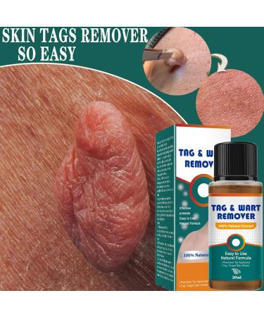 Beauty Grain Corrector | Quick Wart Removal 20ml Blemish Corrector Solution Beauty Home Travel Pre-Event Personal Toiletry Women Men - Buy Online on GoSupps.com