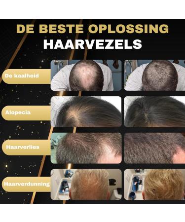 SD SALVATHOR DURAN Salvathor Duran Hair Fibers 25 g Pack 3 Units Hair Fiber + Applicator + Comb Brown - Buy Online on GoSupps.com