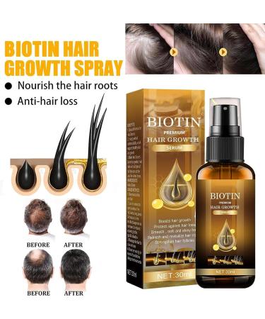 Ibealee Biotin Hair Growth Mist Ibealee Hair Growth Essential Oil Biotin Herbal Essence Ginger Hair Growth Essence - Buy Online on GoSupps.com