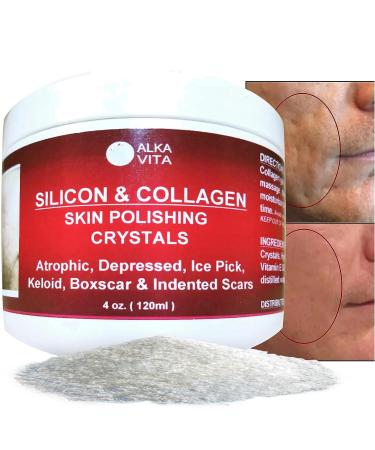 Clear Alka Vita Acne Scars Gel - Silicon & Collagen Crystals for Atrophic & Keloid Scars - 4.0 Fl Oz - Buy Online on GoSupps.com