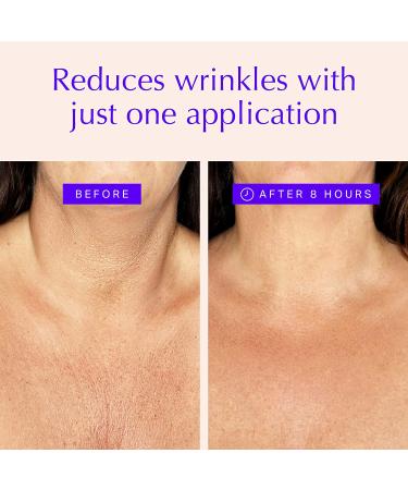 Chest & Neck Wrinkle Pads - Reusable Anti-Aging Silicone Patches for Firming & Tightening - Best Seller - Buy Online on GoSupps.com