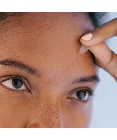 Invisible Pimple Patches (54 pcs) with Niacinamide | Hydrocolloid Patches for Overnight Healing | Thin & Wearable Under Makeup | Reduces Redness and Absorbs Impurities - Buy Online on GoSupps.com