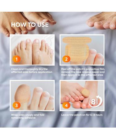 Toenail Fungus Treatment Patches - 1% Tolnaftate 8-Hour Renewal for Effective Nail Care (32 Count) - Buy Now for Fast International Shipping - Buy Online on GoSupps.com