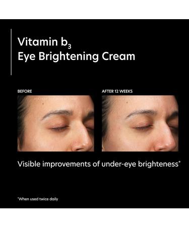 PCA SKIN Vitamin B3 Eye Brightening Cream Anti-Aging Eye Cream for Dark Circles Wrinkles & Uneven Skin Tones Niacinamide Formula 1 oz Tube - Buy Online on GoSupps.com
