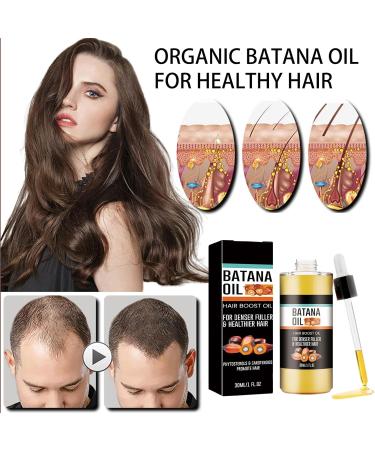 Batana Oil for Hair Growth Organic Batana Oil for Healthy Hair Natural Batana Oil Enhances Hair & Skin Radiance Hair Growth Oil for Stronger Thicker Leaves Your Hair Smoother Oil (Black-Hair Oil) - Buy Online on GoSupps.com