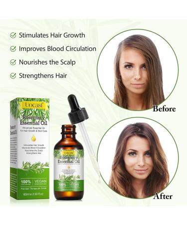 Uocasi Hair Growth Oil - 2 Pack Rosemary Essential Oil Serum (120ML) | 100% Pure Natural Formula to Prevent Hair Loss Slow Graying Enhance Luster & Reduce Dandruff - Buy Online on GoSupps.com