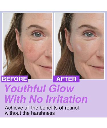 Korean Bakuchiol Serum 30 000 ppm | High-Potency Retinol Alternative for Wrinkle Reduction & Skin Firming - Vegan Cruelty-Free Non-GMO 1 oz - Buy Online on GoSupps.com