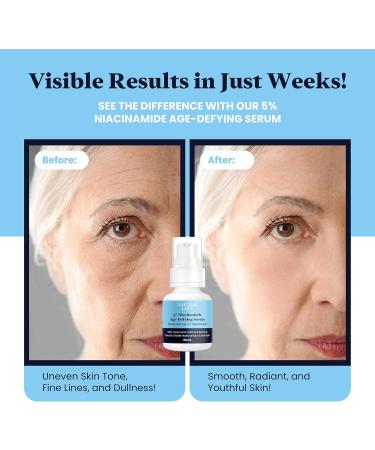 Natural Love 5% Niacinamide Serum (Vitamin B3) 5% B5 Gel Hydrating and Moisturizing Face Serum for All Skin Types - Made in Canada - Buy Online on GoSupps.com