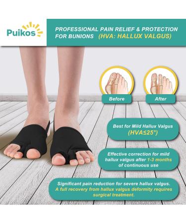 Puikos Hallux Valgus Toe Separator Set | Bunion Corrector Socks & Big Toe Strap | 2 Toe Spreader for Men & Women - Small Black - Buy Online on GoSupps.com