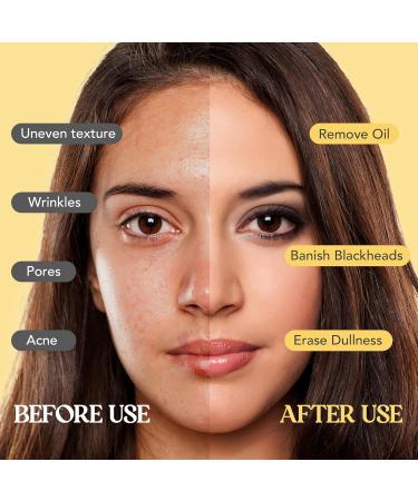 Neatique Vitamin C Clay Mask - 7.05 Oz Turmeric Facial Mask for Deep Cleansing Detox and Skin Tone Repair - Boost Complexion & Reduce Dark Spots - Buy Online on GoSupps.com