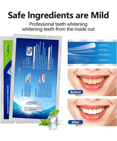Teeth Whitening Strips for Sensitive Teeth - Removes Smoking, Coffee, & Wine Stains - Dental Care Kit with 28 Whitener Strips - Mint Flavor - Buy Online on GoSupps.com