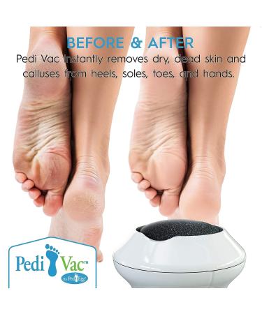 Rechargeable Electric Foot File PediVac - Callus Remover with Built-In Vacuum | Mess-Free Exfoliation for Feet | 2000 RPMs for Dead Skin Removal - Buy Online on GoSupps.com