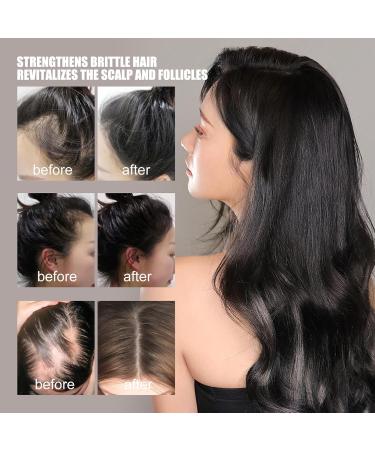 Hair Growth Serum Ginger Hair Growth Oil for Bald Thin Hair Repairs Hair Follicles Stronger Hair Hair Growth Oil for Women & Men - Buy Online on GoSupps.com