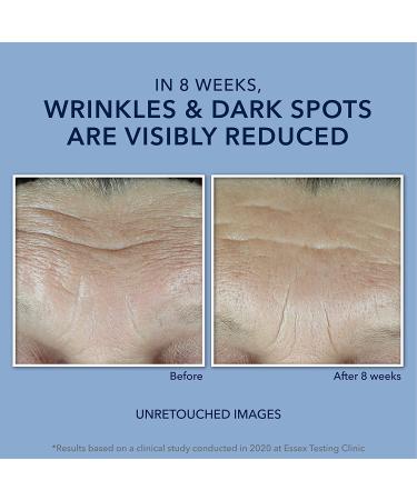 RoC Retinol Correxion Max Hydration Cream 1.7 oz - Fragrance Free Anti-Aging Moisturizer - Buy Online on GoSupps.com