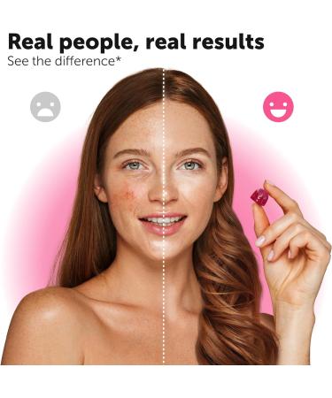 2 Pack Biotin Gummies 10000mcg for Healthy Hair Skin Nails - Vegetarian Non-GMO Vitamins - 120 Gummies for Hair Growth - Buy Online on GoSupps.com