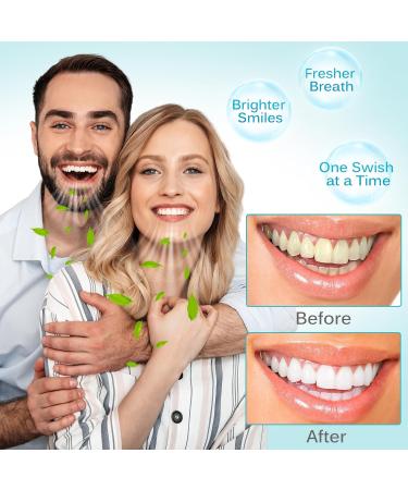 SDJUFEI Coconut Pulling Oil Oil Pulling Travel Sachets 20Pcs Mint Oil Pulling Mouthwash for Teeth Travel Sizes Natural Coconut Oil Pulling with Coconut & Peppermint Oil-Mouthwash - Buy Online on GoSupps.com