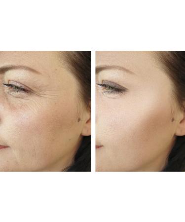 Fractionated Coconut Oil - Pure, Medium Chain Triglycerides, Undiluted, Non-GMO, from Coconut Fruit not Palm, Bulk 128 oz / 1 Gallon - C8 C10, Natural, MCT, Carrier for Skin, Hair, Nails, Body - Buy Online on GoSupps.com