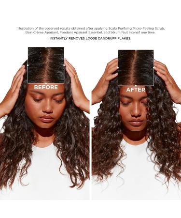 K rastase Symbiose Bain Cr me Apaisant Shampoo Removes Loose Dandruff Flakes Cleanses and Hydrates Scalp & Hair Sulfate-Free Formulated with Zinc Pyrithione 250ml - Buy Online on GoSupps.com