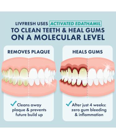 Clinically Proven Toothpaste Gel - Remove Plaque 250% Better Improve Gum Health 190% Tartar Prevention Peppermint Flavor Whitening Non-Foaming - Buy Online on GoSupps.com