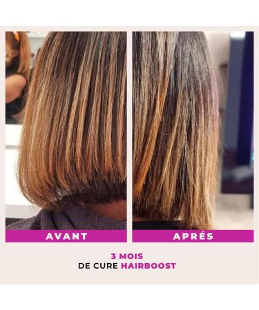 Madame La Pr sidente Hair Boost - Dietary Supplements for Longer Stronger Hair - Effective & Natural Formula for All Hair Types - 60 Gummies for 1 Month - Buy Online on GoSupps.com