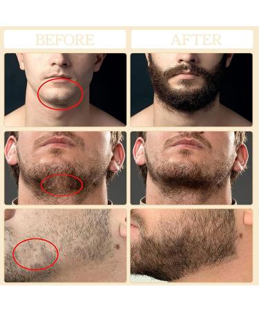 Beard Growth Kit for Men - Beard Roller, Growth Oil, Balm, Comb, Scissors - Birthday Father's Gift - Buy Online on GoSupps.com