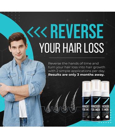 Minoxidil 5% Foam by FolliGuard - 3 Month Supply | Hair Regrowth for Men with Biotin and Herbs - Buy Online on GoSupps.com