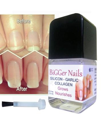 Nails Growth Thickener Gel - BiGGer Nails with Silicon Garlic Extract Collagen Jojoba Oil & Vitamin E for Stronger Healthier Nails - International Shipping Available - Buy Online on GoSupps.com