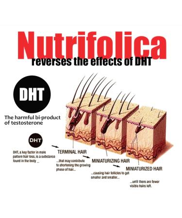 Nutrifolica Hair Loss Solution - Regrow Frontal Crown & Receding Hairline | Best Results Worldwide - Buy Online on GoSupps.com