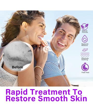 Azelaic Acid Serum Skin Brightening Acid Skin Care Treatment for All Skin Types Fade and Repair Dark Spots 20g - Buy Online on GoSupps.com