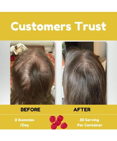 Premium Hair Skin and Nails Gummies 5000 Mcg Biotin Vegan Vitamins for Men & Women Promotes Healthy Hair Growth, Strong Nails, Radiant Skin 10X Extra Strength - Blueberry Flavour - Buy Online on GoSupps.com