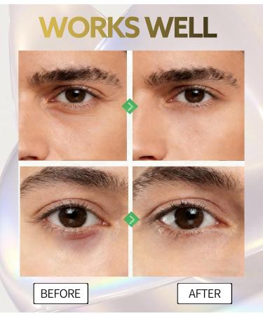 Eye Bags Treatment for Men and Women Caffeine Eye Cream with Roller for Dark Circles & Puffiness Anti Aging Formula with Hyaluronic Acid Retinol & Niacinamide to Reduce Wrinkles and Fine Lines - Buy Online on GoSupps.com