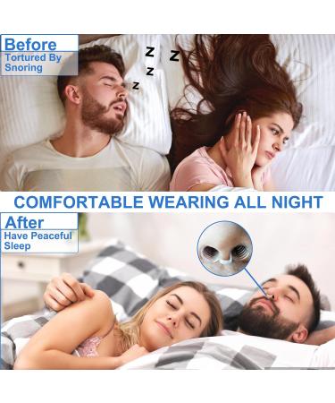 8 Pack Anti Snoring Nasal Dilators - Silicone Stopper Breathing Aid for Snore Relief - 2 Styles, 4 Sizes - Buy Online on GoSupps.com