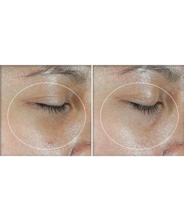 RoC Multi Correxion Revive + Glow Eye Balm Vitamin C + Peptide Formula Dark Circle Reduction Touchless Application Eye Cream - 4g - Buy Online on GoSupps.com