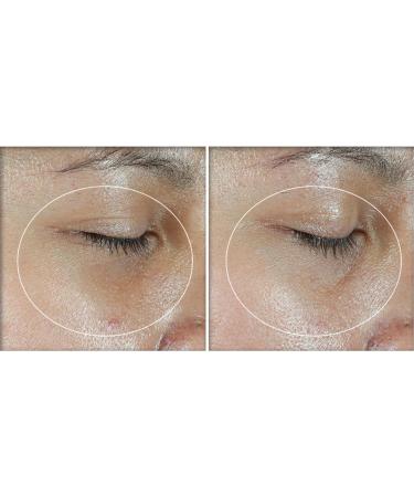 RoC Multi Correxion Revive + Glow Vitamin C with Peptides Eye Balm for Brighter Eyes 4G - Buy Online on GoSupps.com