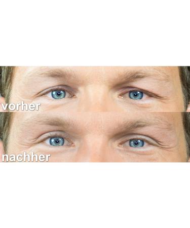 Sluepflid Tape Lady Size (L) - 120 Pieces Eyelid Lifting Strips for Beautiful Eyes | Non-Surgical Eye Leverage Tape - Buy Online on GoSupps.com