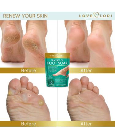 LOVE LORI Tea Tree Oil Epsom Salt Foot Soak 16oz Pedicure & Spa Soaking Salts for Dry Cracked Feet Natural Essential Oils - Buy Online on GoSupps.com