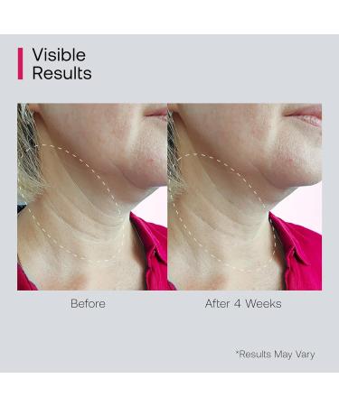 Neck Cream for Tightening and Firming: Hydrates, Lifts & Smoothes with Cooling Massaging Roller Applicator - with Retinol, Niacinamide & Hyaluronic Acid for Face, Neck & Chest, 1.7 OZ/50g 1.7 Ounce (Pack of 1) - Buy Online on GoSupps.com