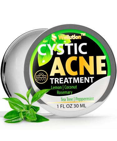 Cystic Acne Treatment and Acne Scar Remover - Made in USA - Effective Face & Body Severe Acne Cleanser with Tea Tree Oil - Prevent Future Breakouts - Natural Acne Spot Pimple Cream