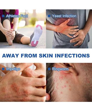 Antifungal Medicated Soap Bar | Tea Tree Oil Body Soap for Athletes Foot Jock Itch Ringworm & Yeast Infection Treatment | Natural Eucalyptus & Lavender Oil - Buy Online on GoSupps.com