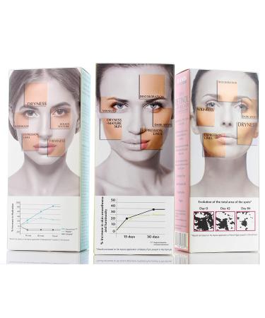 Reventin Collagen Serum with Hyaluronic Acid 1.5 Fl Oz - Hydrating Serum for Dry Skin & Wrinkles - Buy Online on GoSupps.com