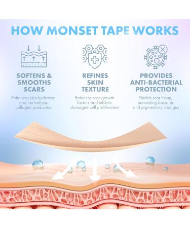 Silicone Scar Tape for Effective Scar Removal | Medical Grade 130x1.5 Inch Roll for Surgical Acne & Keloid Scars - Buy Online on GoSupps.com