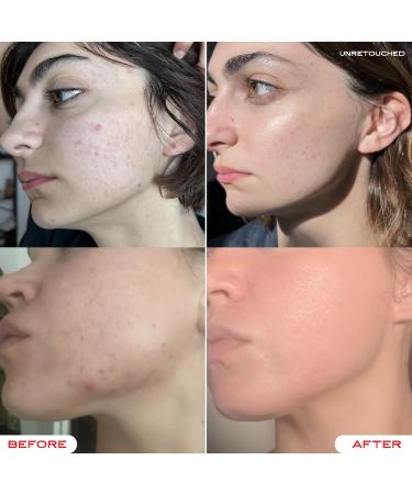 Darlin Skincare Tallow Face Balm - Organic Grass-Fed Moisturizer for Glowy Skin | Nontoxic Beauty for Acne Eczema & Rosacea - Buy Online on GoSupps.com