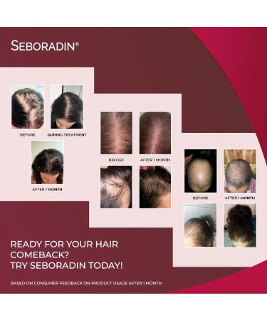 SEBORADIN Maria Red Set - Derma Roller - Ampoules Forte - S rum Fitocell - S rum de Nuit - Gommage Enzymatique - Shampooing - Baume Hydratant - Cr me Capillaire - Buy Online on GoSupps.com