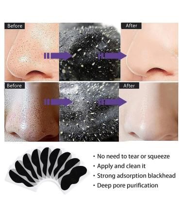 Blackness Nose Strips - 50PC Activated Carbon Pore Strips for Blackhead Removal & Deep Cleansing | Anti-Blackhead Solution - Buy Online on GoSupps.com