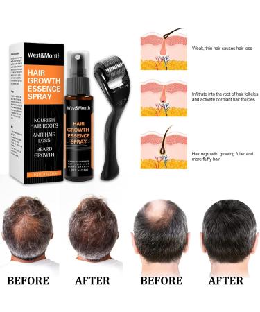 JITASHWA Hair Growth Spray Hair Regrowth Treatment Essence with Beard Growth Roller Hair Growth Serum for Repairing Hair Follicles Preventing Hair Loss Hair Thickening Products for Men & Women - Buy Online on GoSupps.com