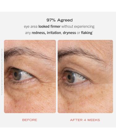 First Aid Beauty Retinol Complex Serum & Eye Cream - Reduce Lines & Wrinkles with Peptides Squalane & Ceramides - Gentle Retinol for All Skin Types - Buy Online on GoSupps.com
