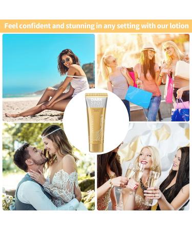 Letebee Dark Spot Corrector Cream | Hyperpigmentation & Dark Armpit Remover | Moisturizing Body Cream for Inner Thigh, Elbows, Knees, Neck, Back, Legs, Private Parts | Natural Skincare with Instant Results - Buy Online on GoSupps.com