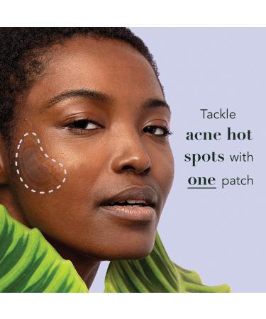 Rael Miracle Patch Spot Control - 10 Acne Patches for Clear Skin - Buy Online on GoSupps.com
