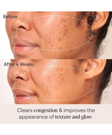 Alpyn Clarifying Facial Oil with Retinol & Pink Algae | Clear Congestion Smooth Fine Lines & Boost Radiance | 1 Fl Oz - Buy Online on GoSupps.com
