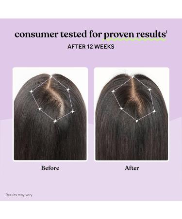 Lemme Grow Hair Growth Supplement for Women Clinically Proven Keratin Complex for Visibly Thicker Hair and Scalp Coverage Reduced Shedding Nourish Thinning Hair - 1 Month Supply - Buy Online on GoSupps.com